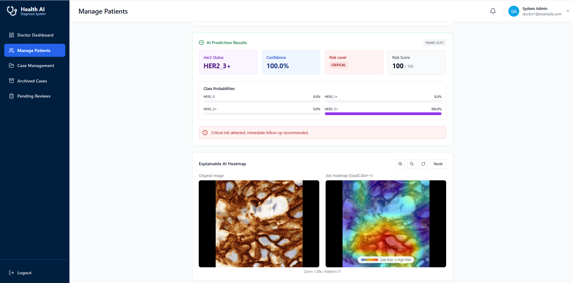 Medx AI prediction result with Grad-CAM heatmap